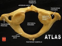 thumbnail of Atlas_vertebrae.jpg