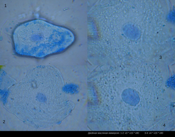 thumbnail of Karyotype0.JPG