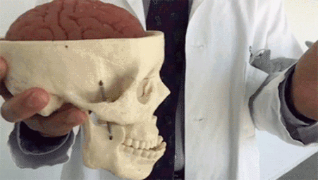 thumbnail of 1741445957075033.gif