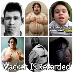 thumbnail of Macker is Retarded.jpg