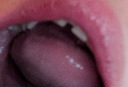 thumbnail of ropefuel mouth.png