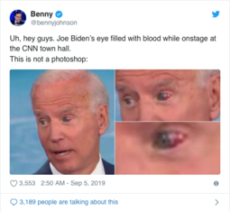 thumbnail of Screenshot_2019-09-05 WATCH Biden's eye fills with blood during CNN climate town hall – True Pundit.png