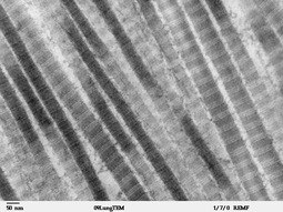 thumbnail of o2_tem_collagen_type1.jpg