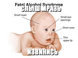 thumbnail of foetal-alcohol-syndrome-1.jpg