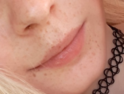 thumbnail of freckles.png