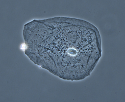 thumbnail of Cheek_Cell_PCM.jpg