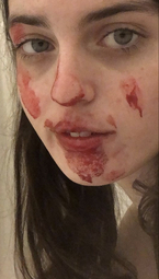 thumbnail of ciara_bloody_face.jpg