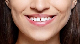 thumbnail of spacing-orthodontics-dr-emilia-taneva-bubbly-moments2.jpg