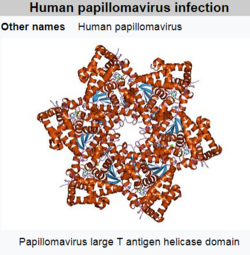 thumbnail of papilloma virus.png
