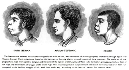 thumbnail of scientific_racism_irish-1899.jpg