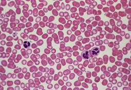 thumbnail of blood_cells_include_neutrophils___rc.jpg