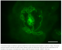 thumbnail of testicular organoid.PNG