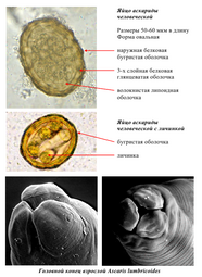 thumbnail of Ascaris Eggs.png