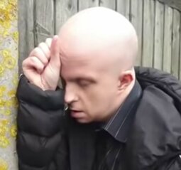 thumbnail of bald nonce.jpg