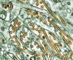 thumbnail of 1280px-Colorized_transmission_electron_micrograph_of_Avian_influenza_A_H5N1_viruses[1].jpg