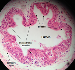 thumbnail of vas_deferens_lumen.png