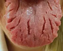 thumbnail of TONGUE.png